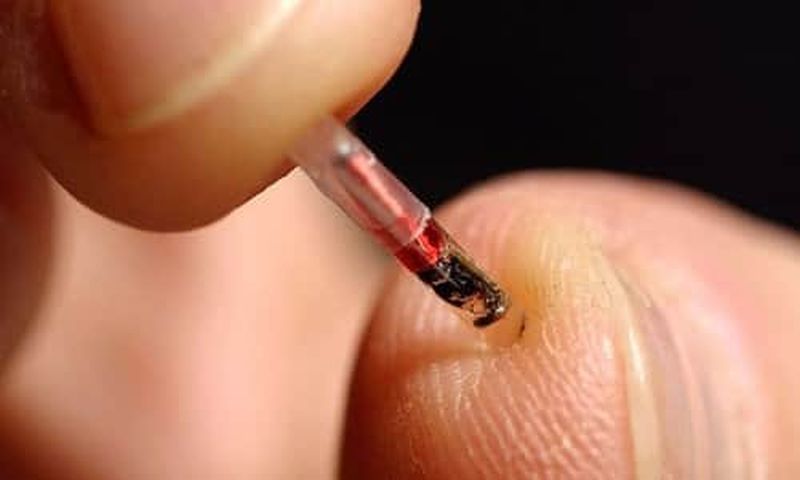 microchip implants