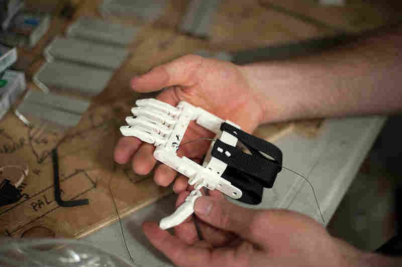 Ivan Owen and Richard Van first made a working prosthetic finger