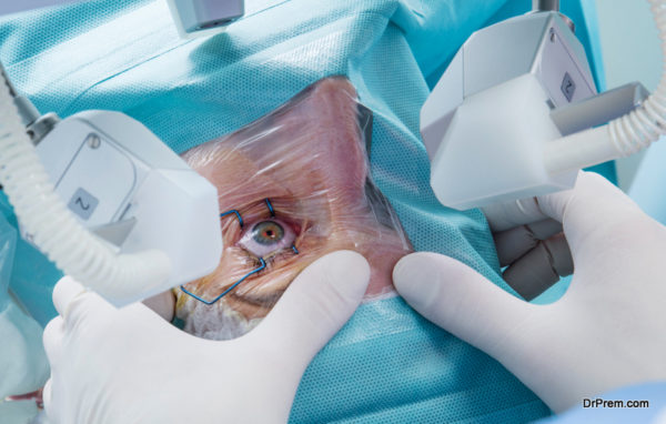 laser eye surgery transformed eye care